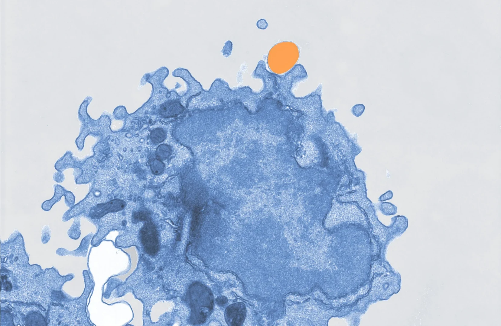 Pseudocolored electron microscope image - of a macrophage (blue) taking up microplastics (orange).