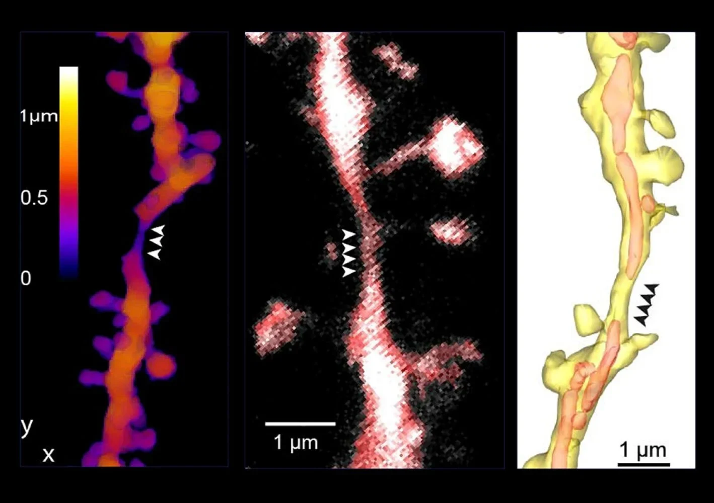 New Findings on Information Processing in the Brain: - Examples of Dendritic Shaft Constrictions (DSCs) imaged used high resolution microscopy techniques, expansion microscopy (left), STED (middle) and electron microscopy (right). Arrowheads indicate the position of DSCs.