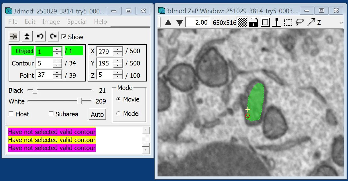 Figure 1: Screenshot of IMOD during the segmentation phase.