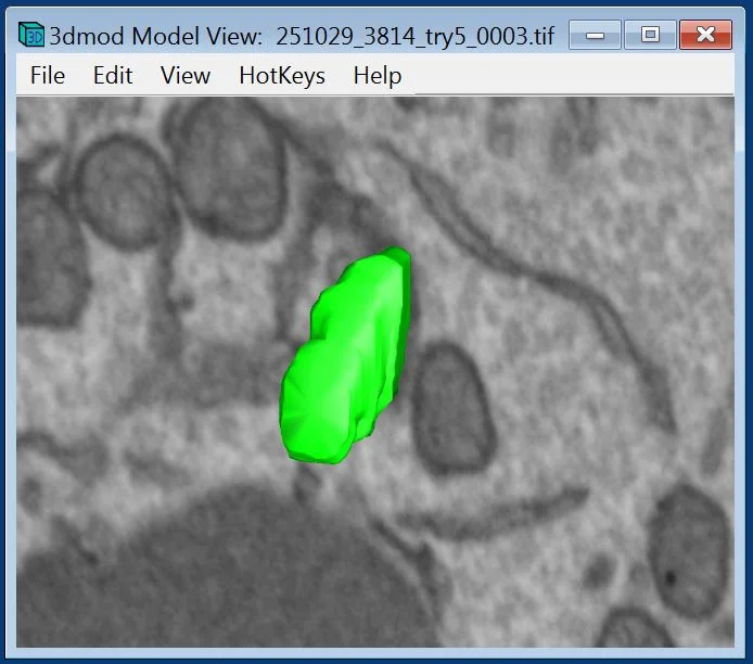 Figure 2: Outcome of IMOD processing.