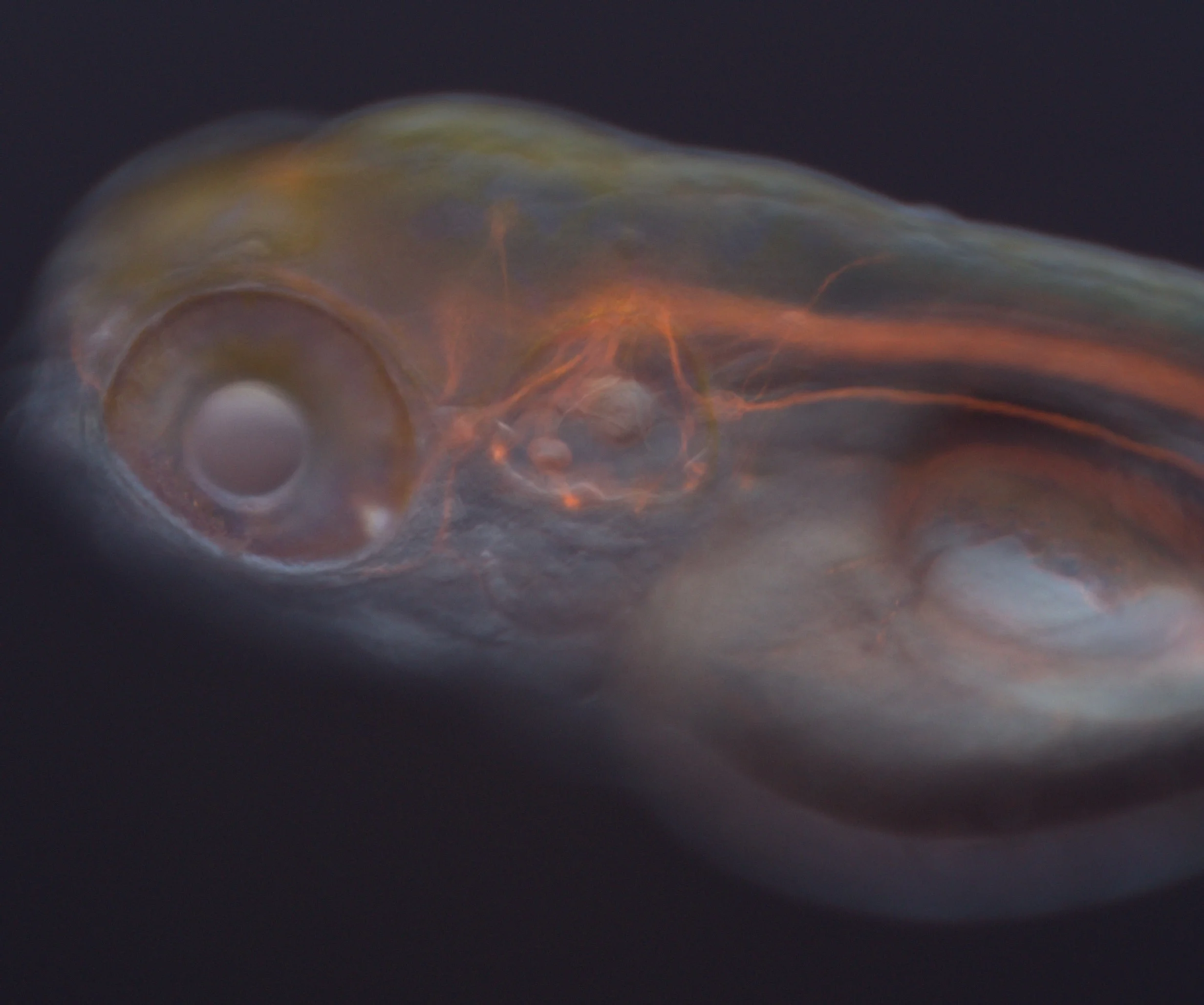 Zebrafish Brain
