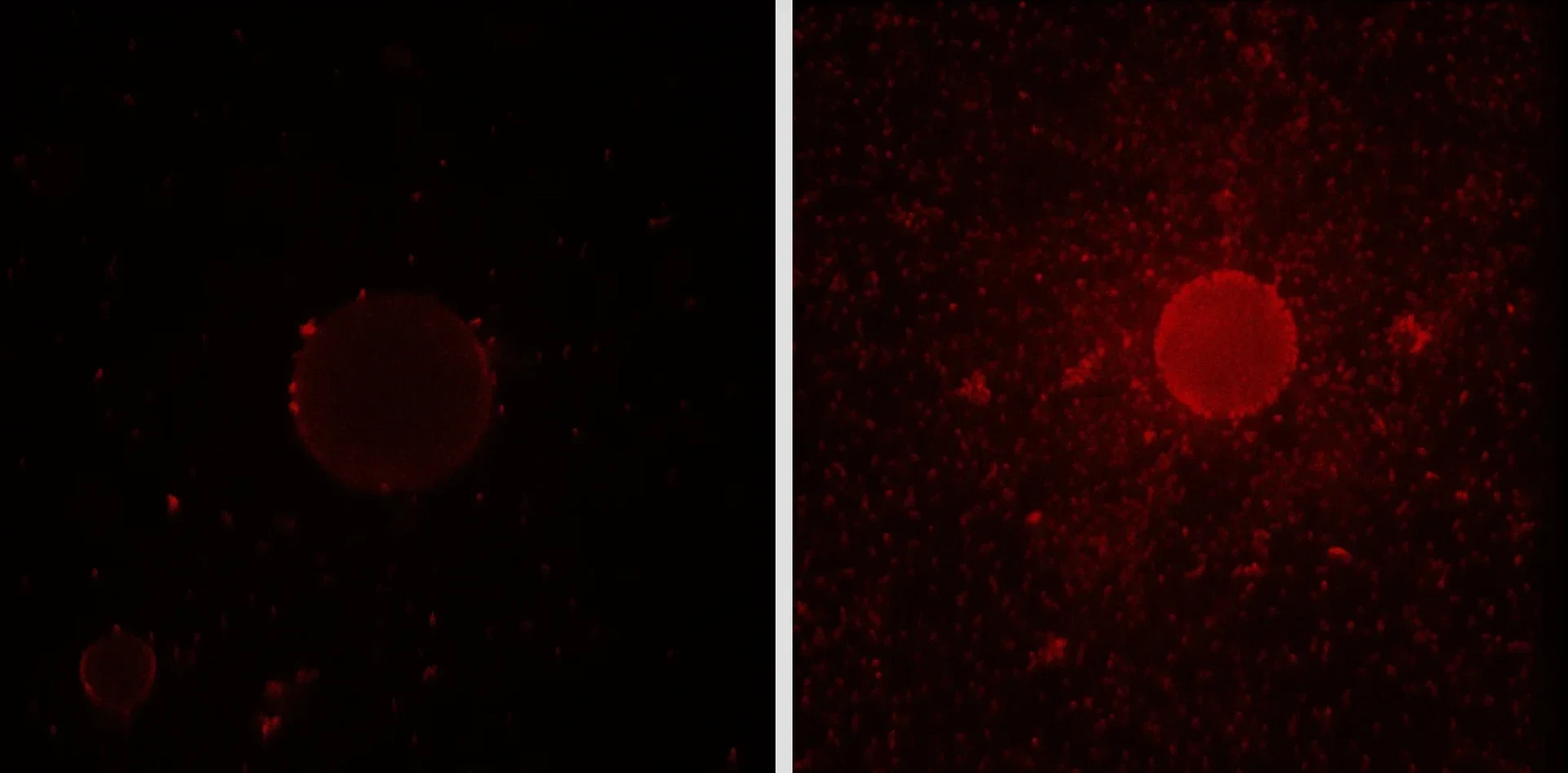 The red-marked bacteria with the gene cluster switched off - were no longer able to synthesize the detergent. The bacteria were then unable to attach to the surface of oil droplets (left) the way they usually do (right).